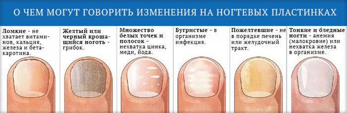 Изменения ногтевой пластины