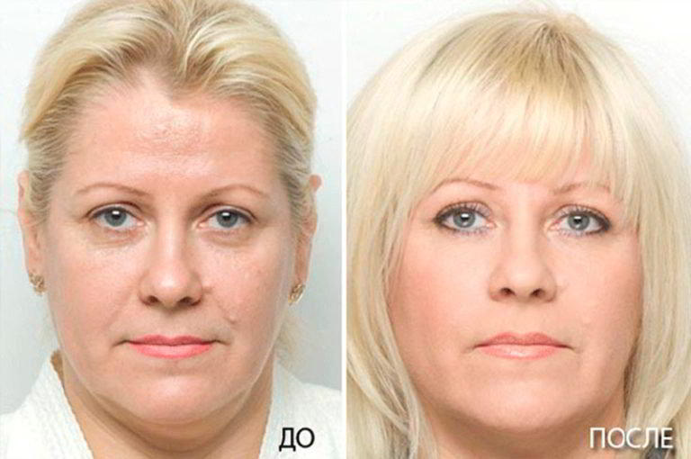 Клиент до и после фото